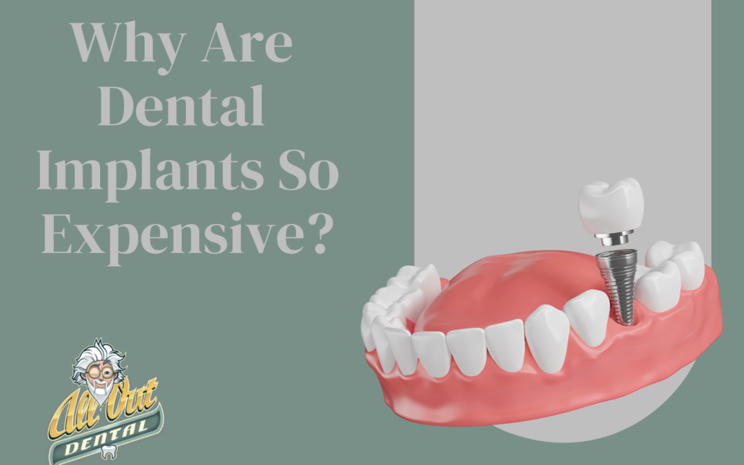Why Are Dental Implants So Expensive?