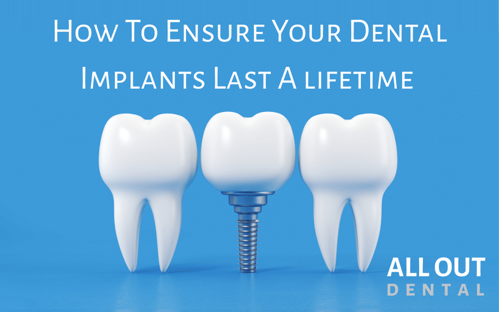 How to Ensure Your Dental Implants Last a Lifetime