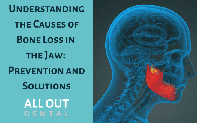 Understanding the cause of bone loss in the jaw