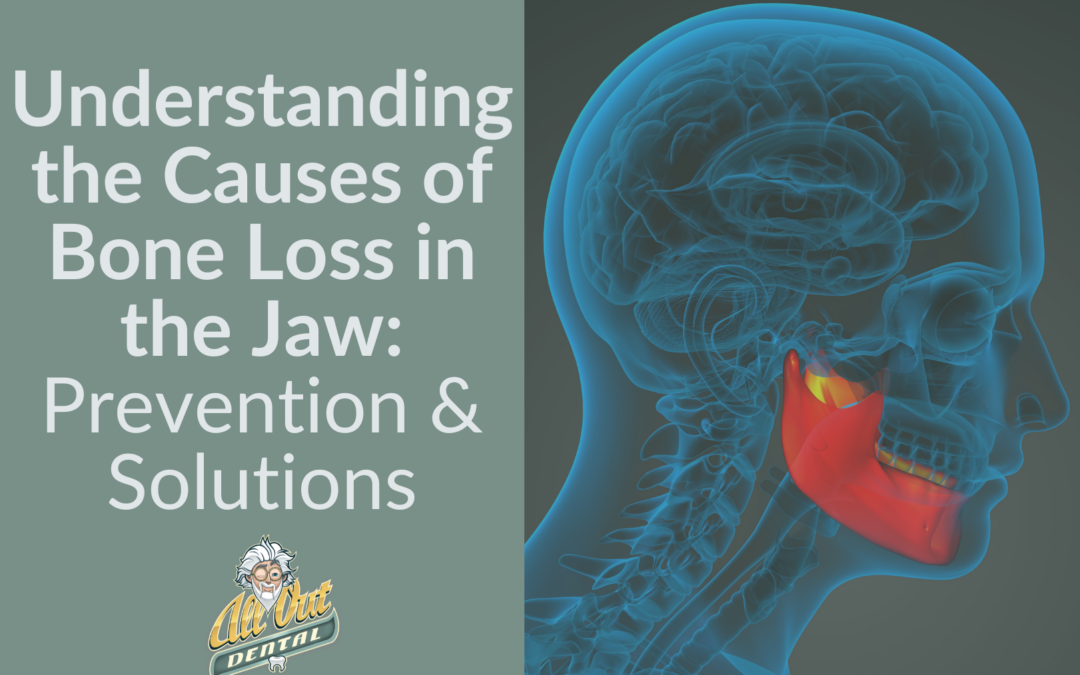 Understanding the Causes of Bone Loss in the Jaw: Prevention and Solutions