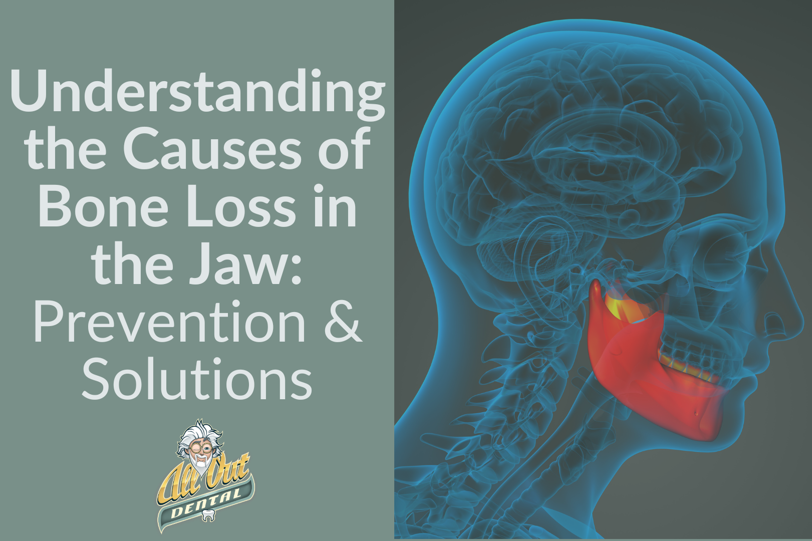 Understanding the Causes of Bone Loss in the Jaw