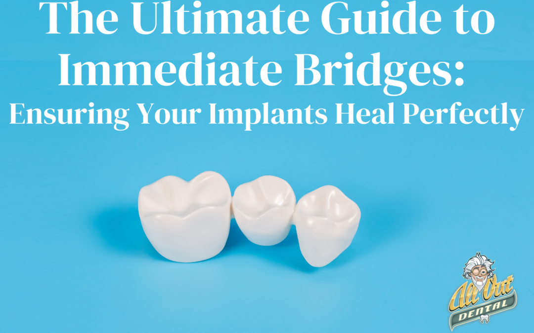 The Ultimate Guide to Immediate Bridges: Ensuring Your Implants Heal Perfectly