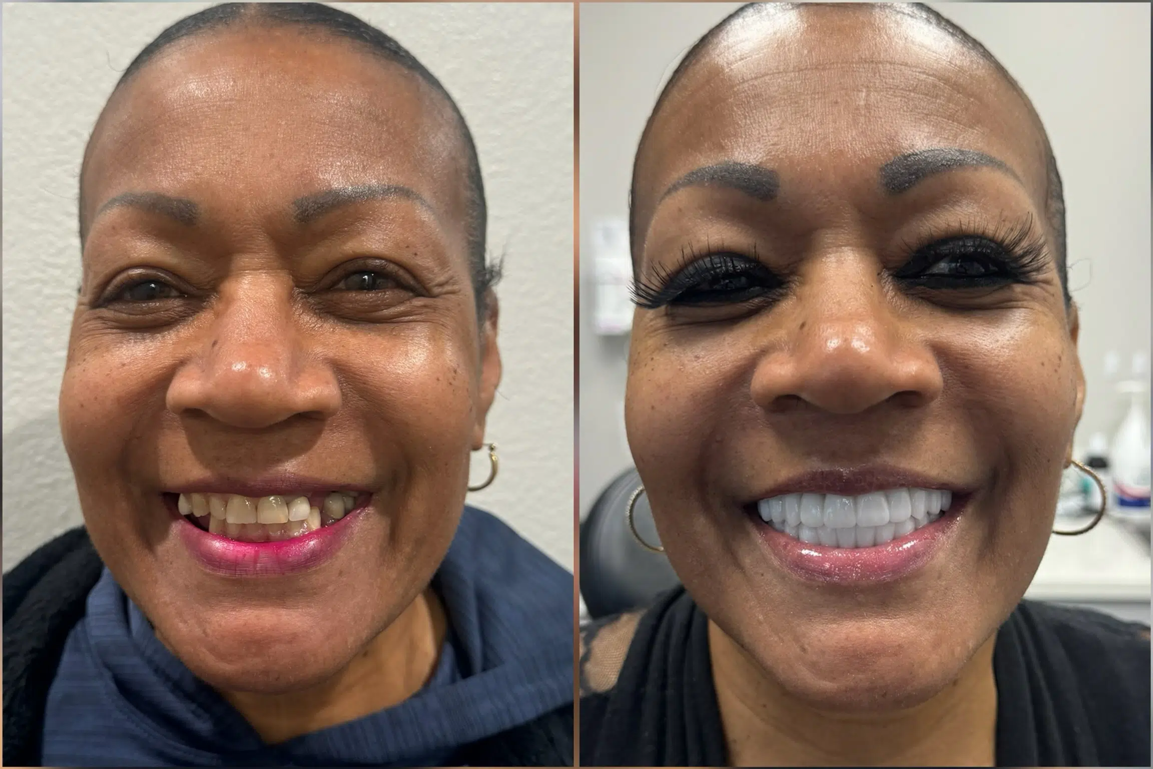 dental implants las vegas patient