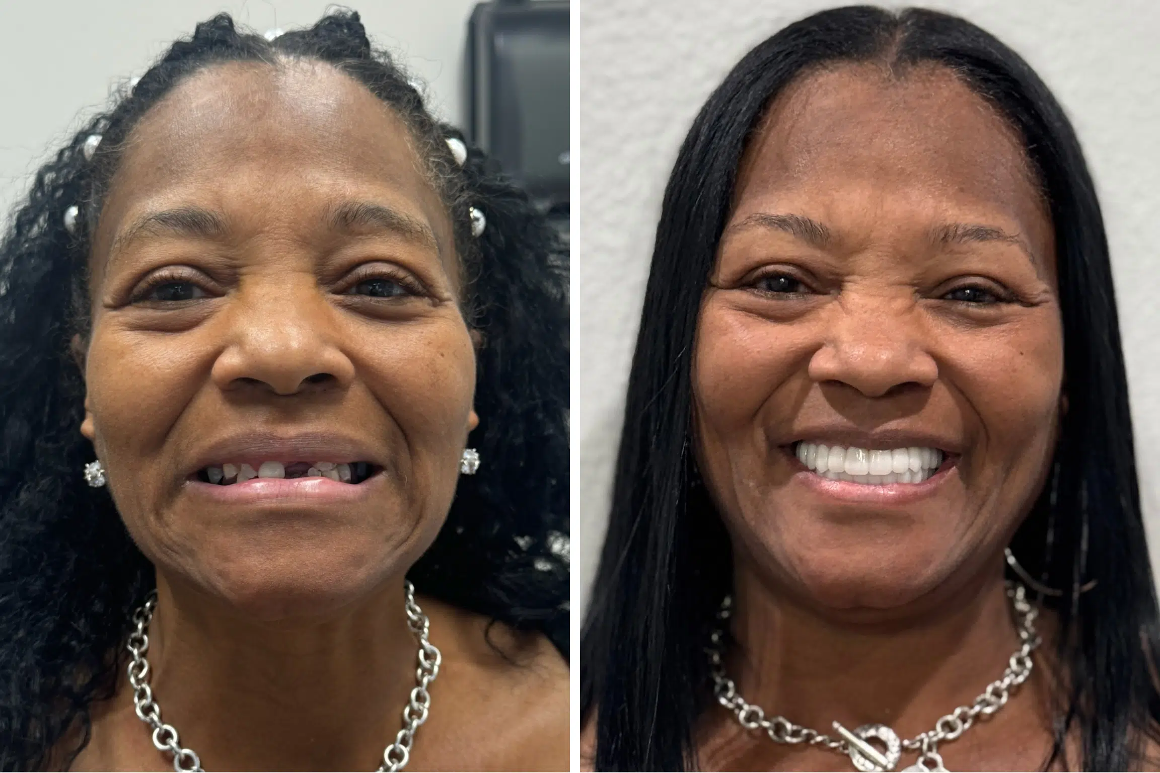 dental implants las vegas patient