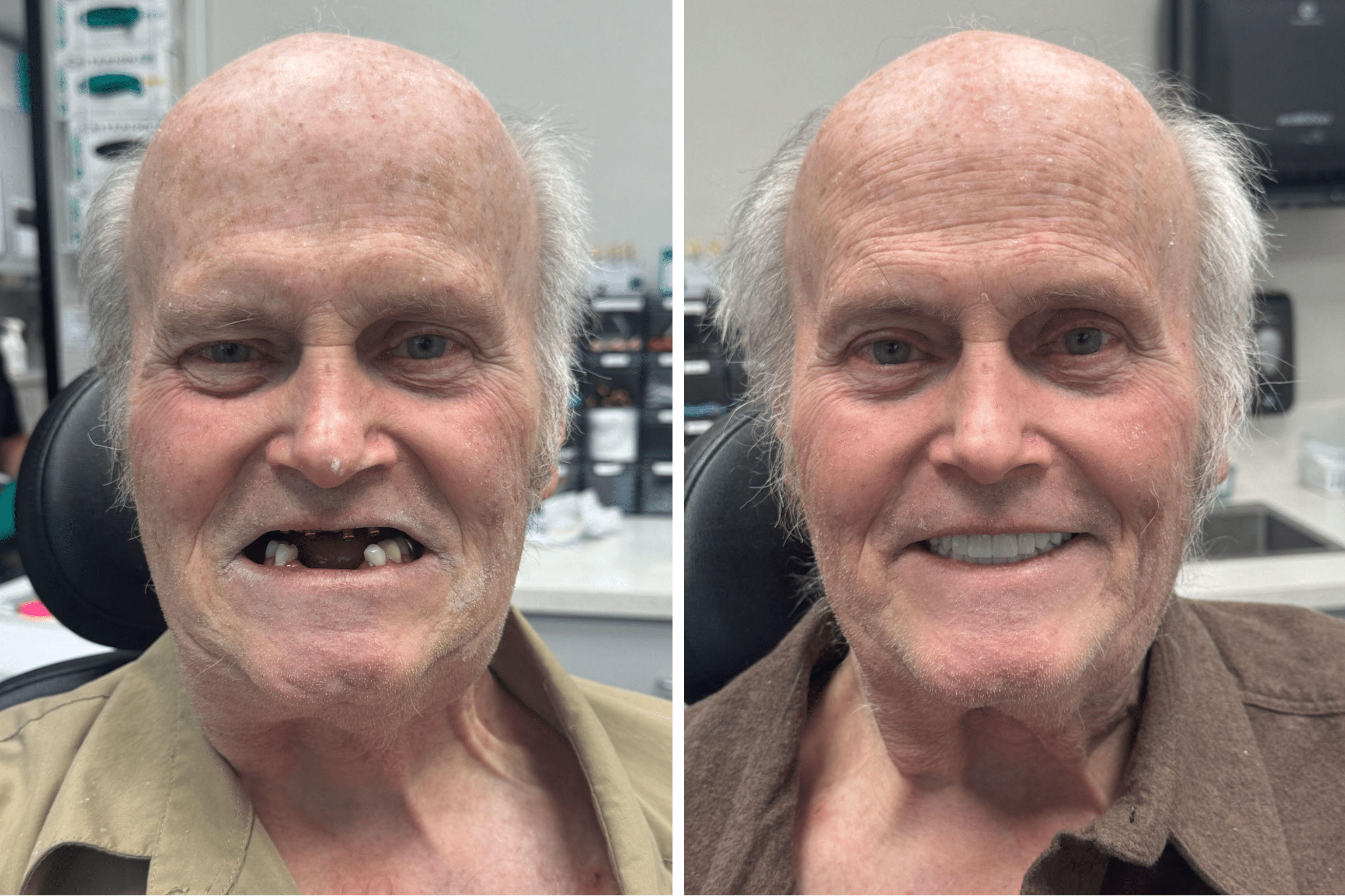 dental implants patient