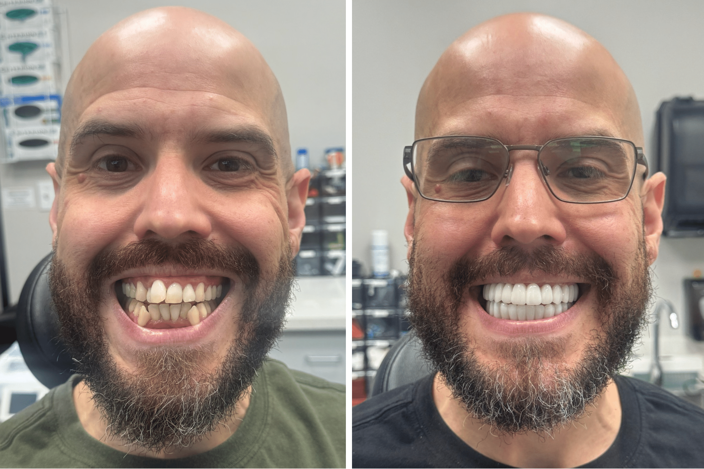 dental implants las vegas patient 