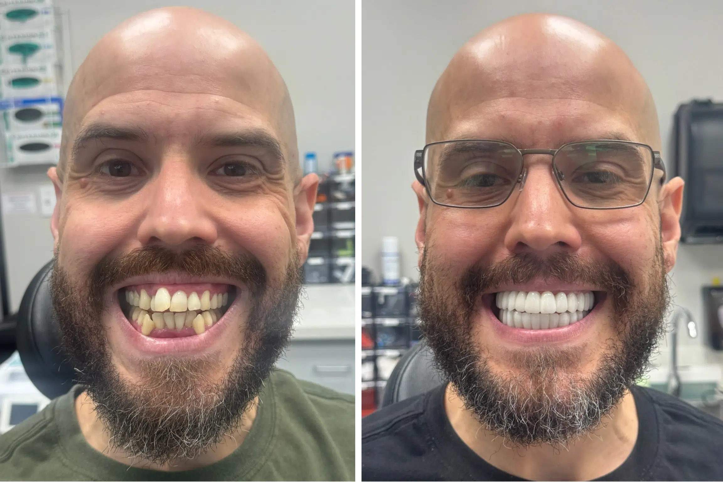 dental implants las vegas patient