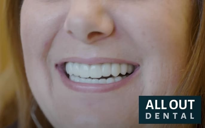 Dental Implant Relief