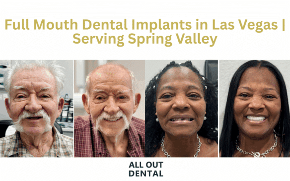 dental-implants-las-vegas-spring-valley