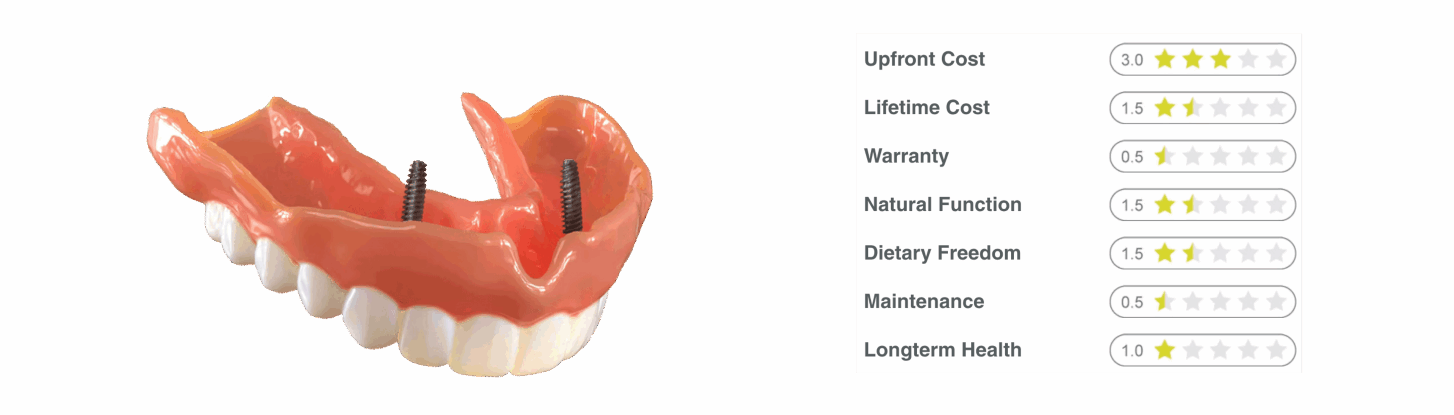 overdenture