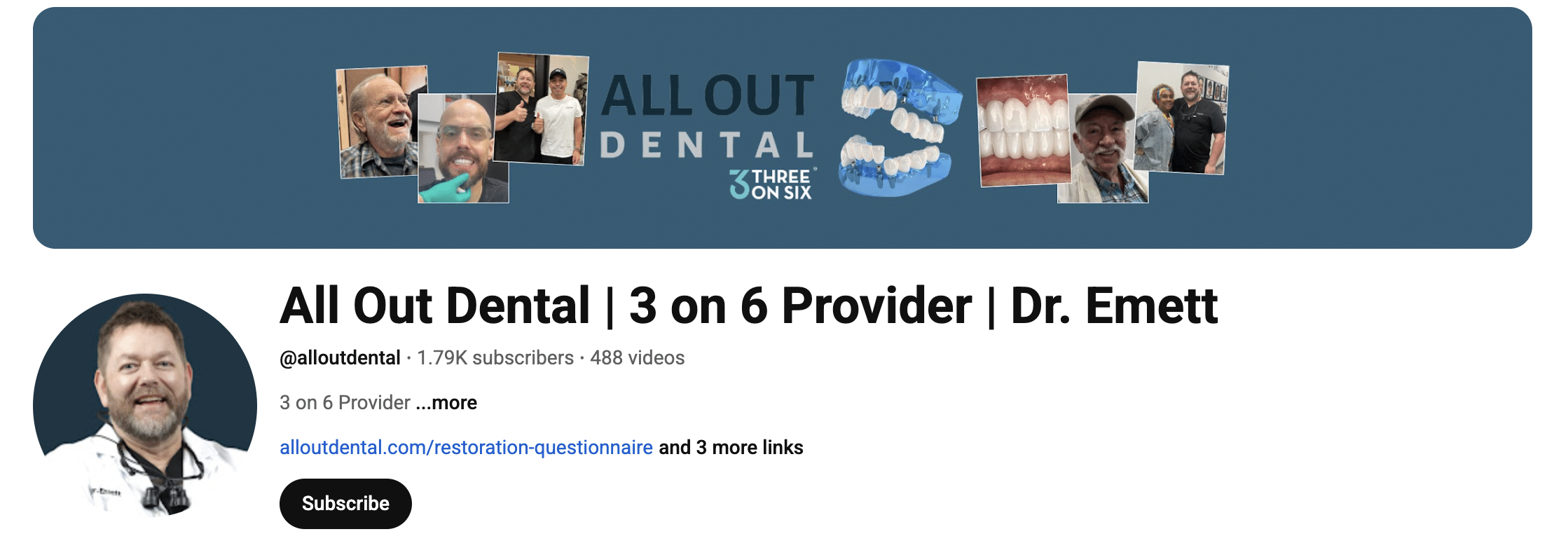 3 on 6 dental implants youtube