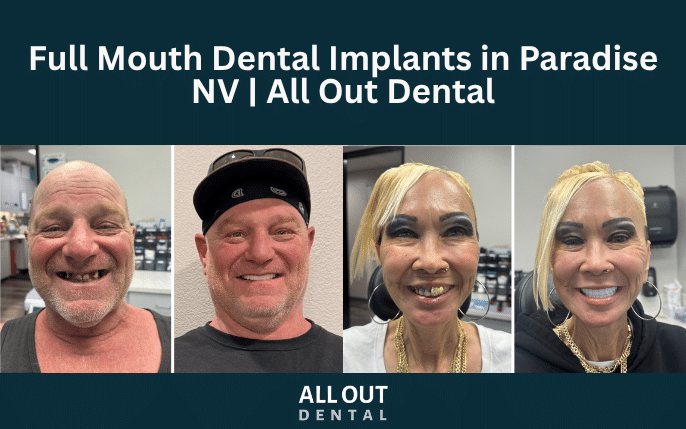 dental-implants-las-vegas-paradise-nv