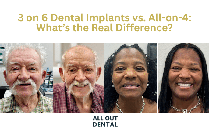 3 on 6 Dental Implants vs. All-on-4: What’s the Real Difference?