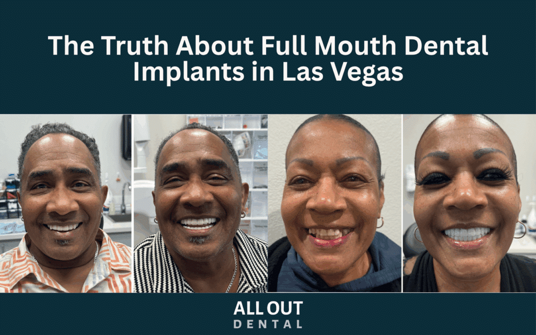 The Truth About Full Mouth Dental Implants in Las Vegas