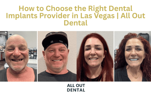 how-to-choose-the-right-dental-implants-provider-in-las-vegas