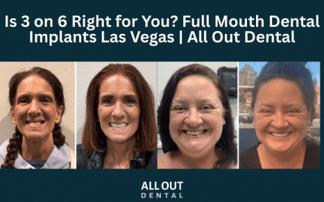 is-3-on-6-right-for-you-full-mouth-dental-implants-las-vegas