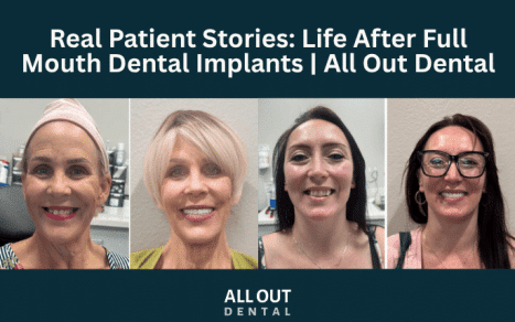 real-patient-stories-life-after-full-mouth-dental-implants