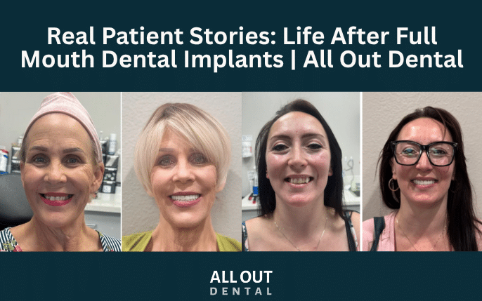 Real Patient Stories: Life After Full Mouth Dental Implants