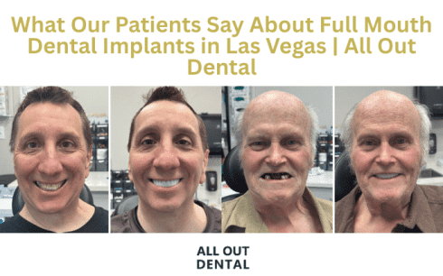 what-our-patients-say-about-full-mouth-dental-implants-in-las-vegas