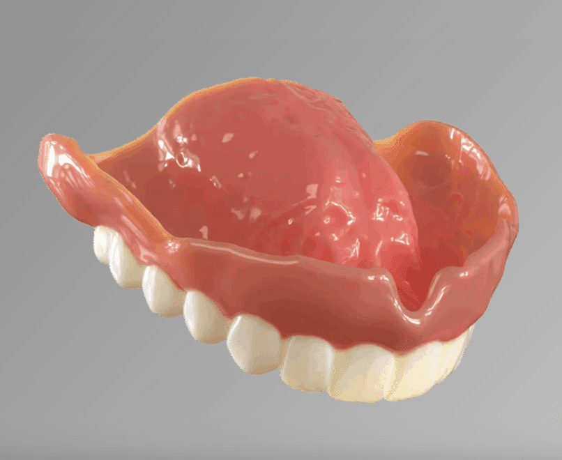 Denture