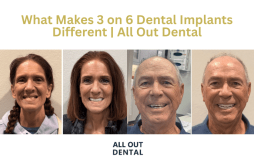 what-makes-3-on-6-dental-implants-different-las-vegas