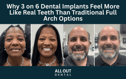 why-3-on-6-dental-implants-feel-more-like-real-teeth-las-vegas