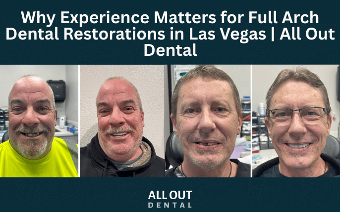 Why Experience Matters for Full Arch Dental Restorations in Las Vegas | All Out Dental