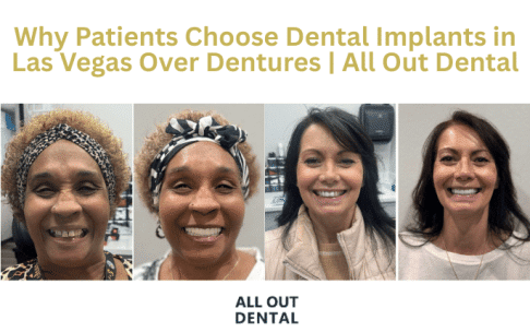 why-patients-are-choosing-dental-implants-in-las-vegas-over-dentures