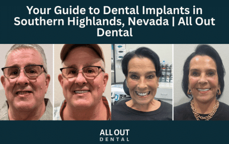 your-guide-to-dental-implants-in-southern-highlands-nevada