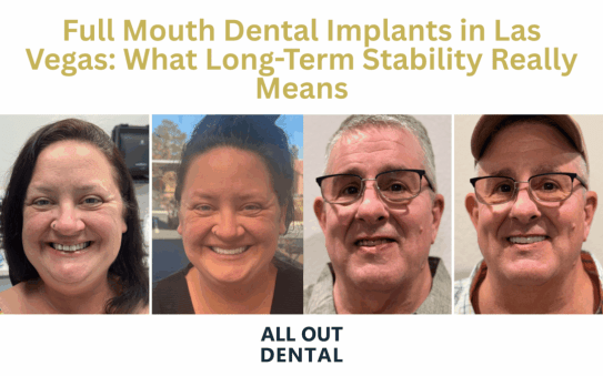 full-mouth-dental-implants-las-vegas-long-term-stability
