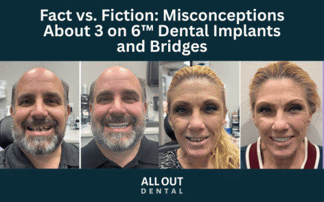 fact-vs-fiction-misconceptions-about-3-on-6-dental-implants-and-bridges.jpg