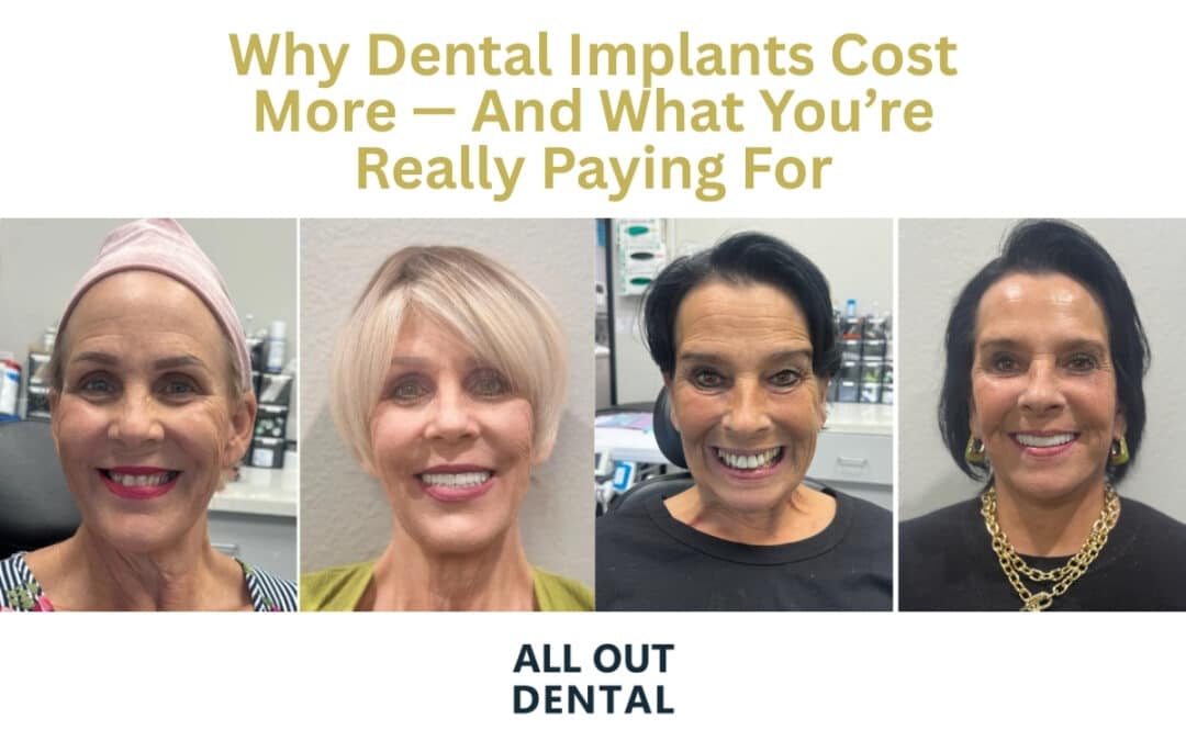 Why Dental Implants Cost More — And What You’re Really Paying For