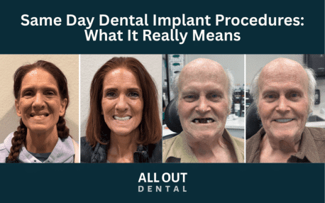 same-day-dental-implants-procedure-las-vegas.jpg