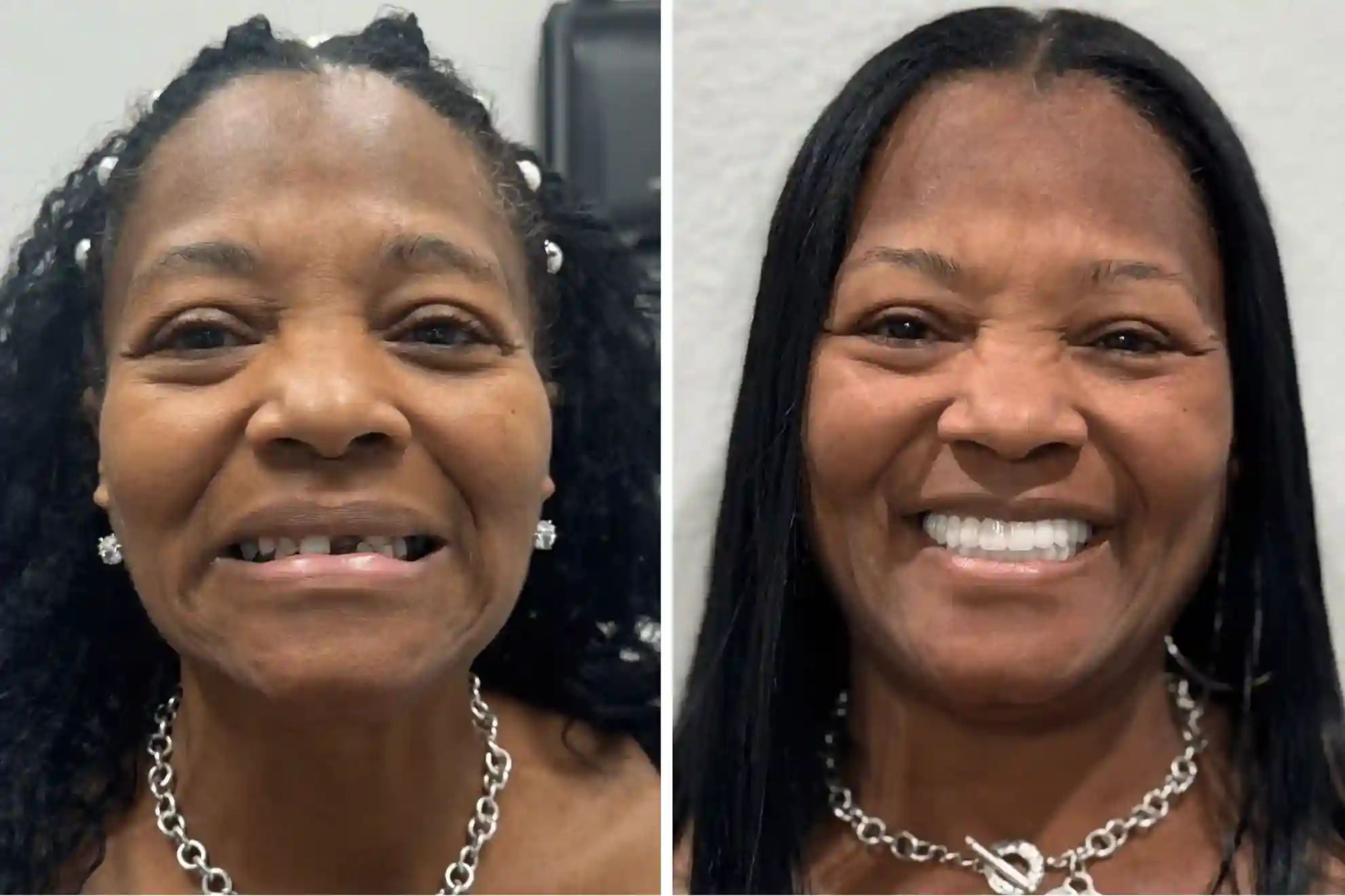 dental implants las vegas patient
