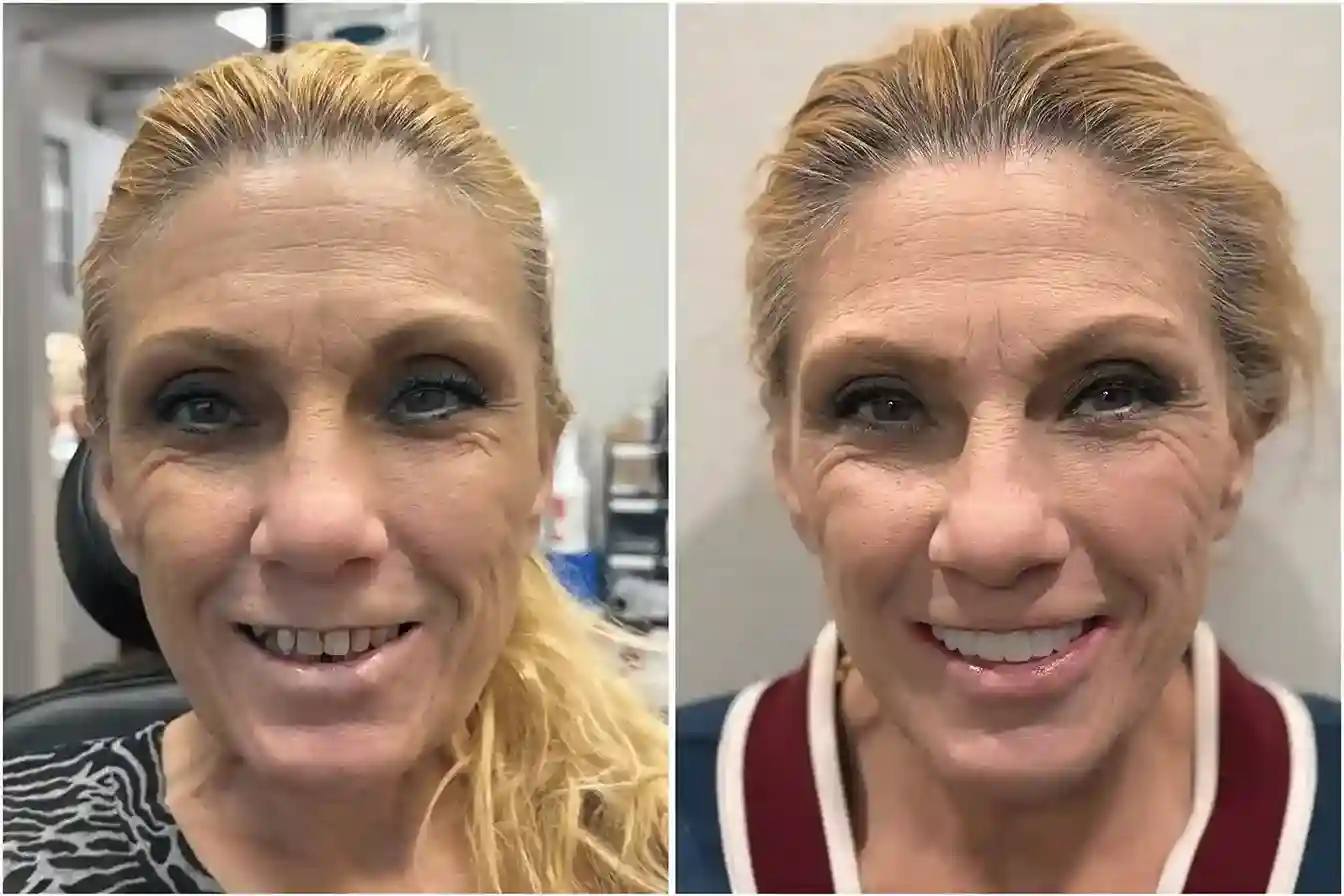 dental implants las vegas patient