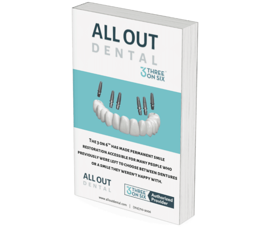 3on6 Full Mouth Restoration Guide