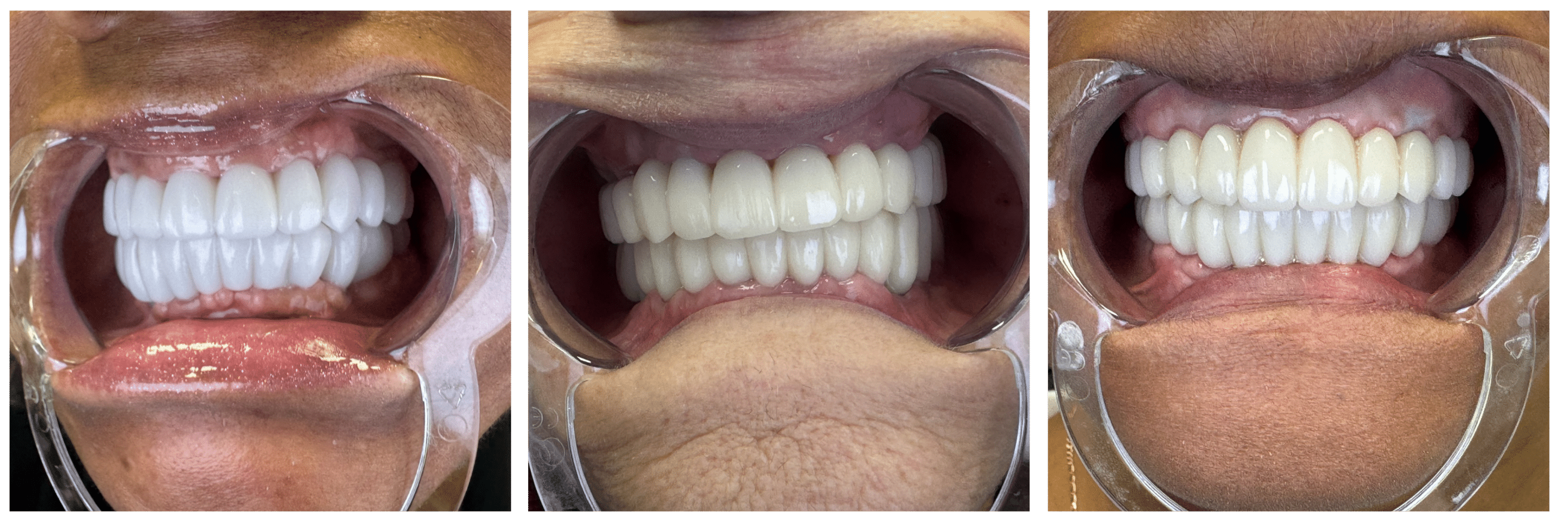 keep your gums